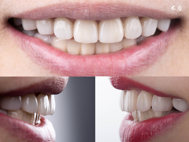 China dental lab manufacturing technology ng zirconia long bridge