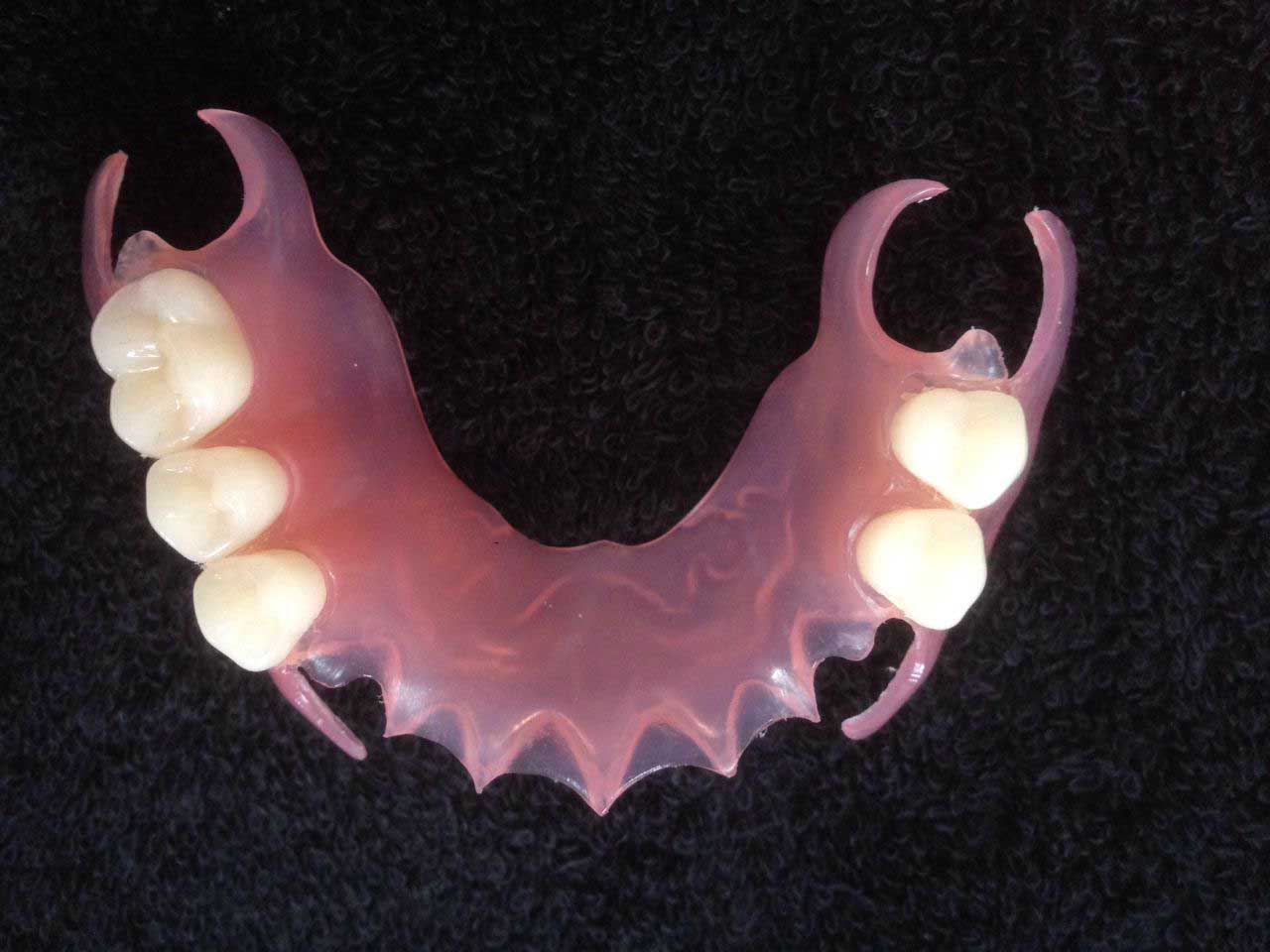 Mabilis at Madali ang Partial Denture Dental Acrylic Teeth sa Dentistry