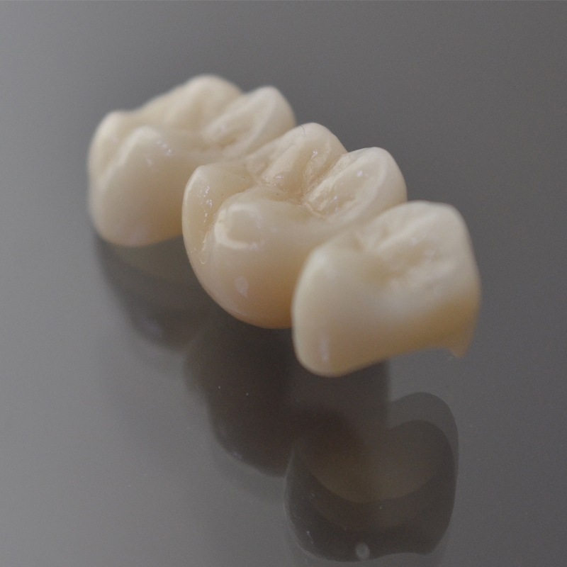 Mga Tampok ng Zirconia Crown