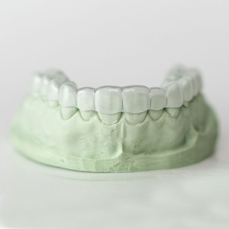 Bakit kailangan mong magkaroon ng orthodontic treatment?