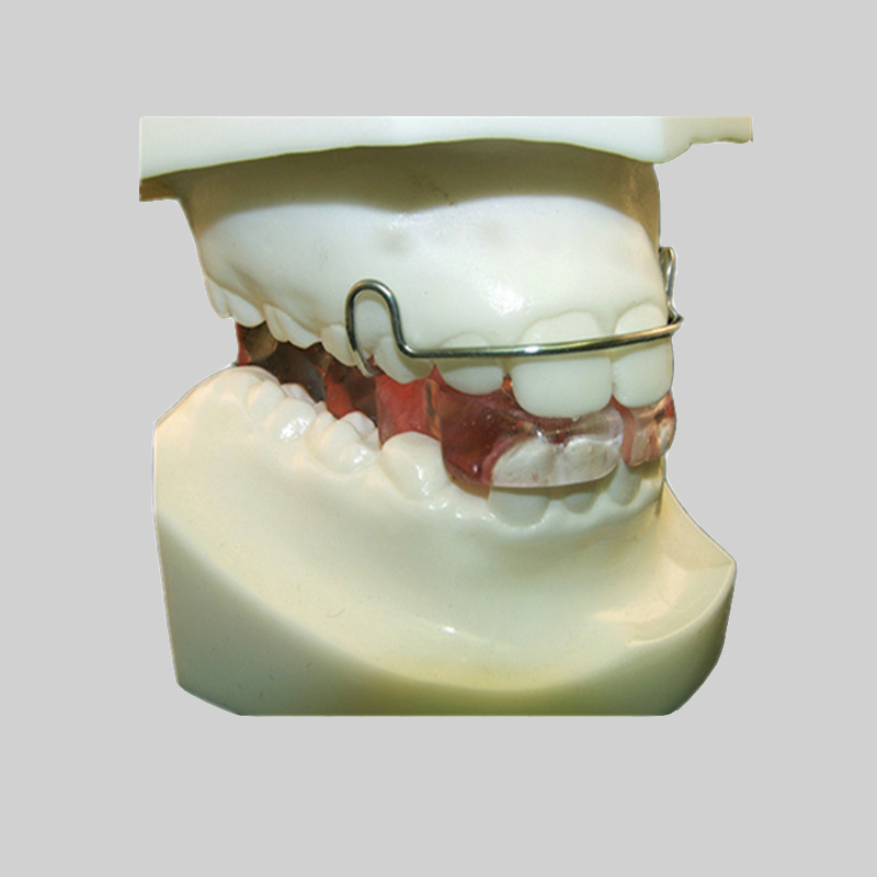 Ano ang pagkakaiba sa pagitan ng orthodontics at orthodontic na paggamot?