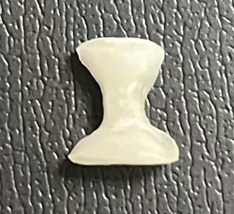 Ano ang isang Inlay?