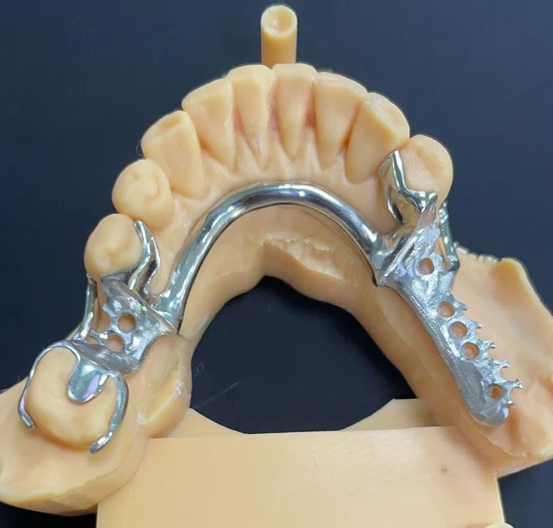 Mga Bentahe ng Cobalt-Chromium Framework (Co Cr Framework)