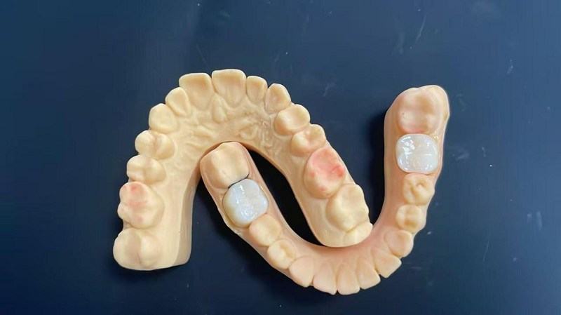 Ano ang gilid ng balikat?