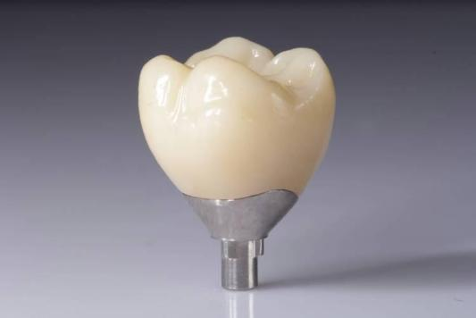 I-optimize ang Iyong Mga Kinalabasan sa Mga Pagpapanumbalik ng Zirconia (Mga Korona, Tulay, Mga Implant)