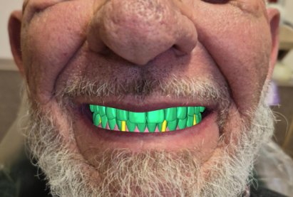 WM Dental Lab