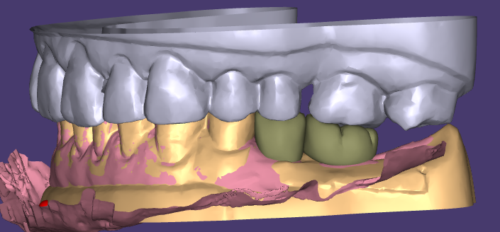 WM Dental Lab