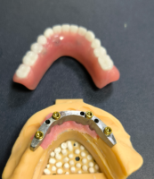 Locator at dental bar