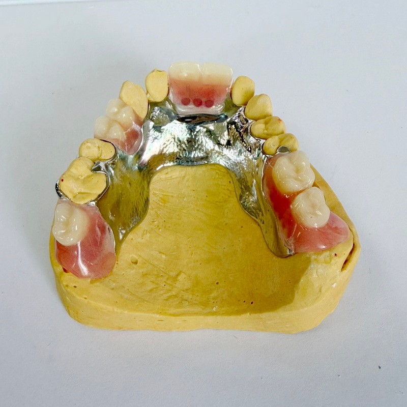 Naaalis na Pagpapanumbalik ng Bahagyang Framework